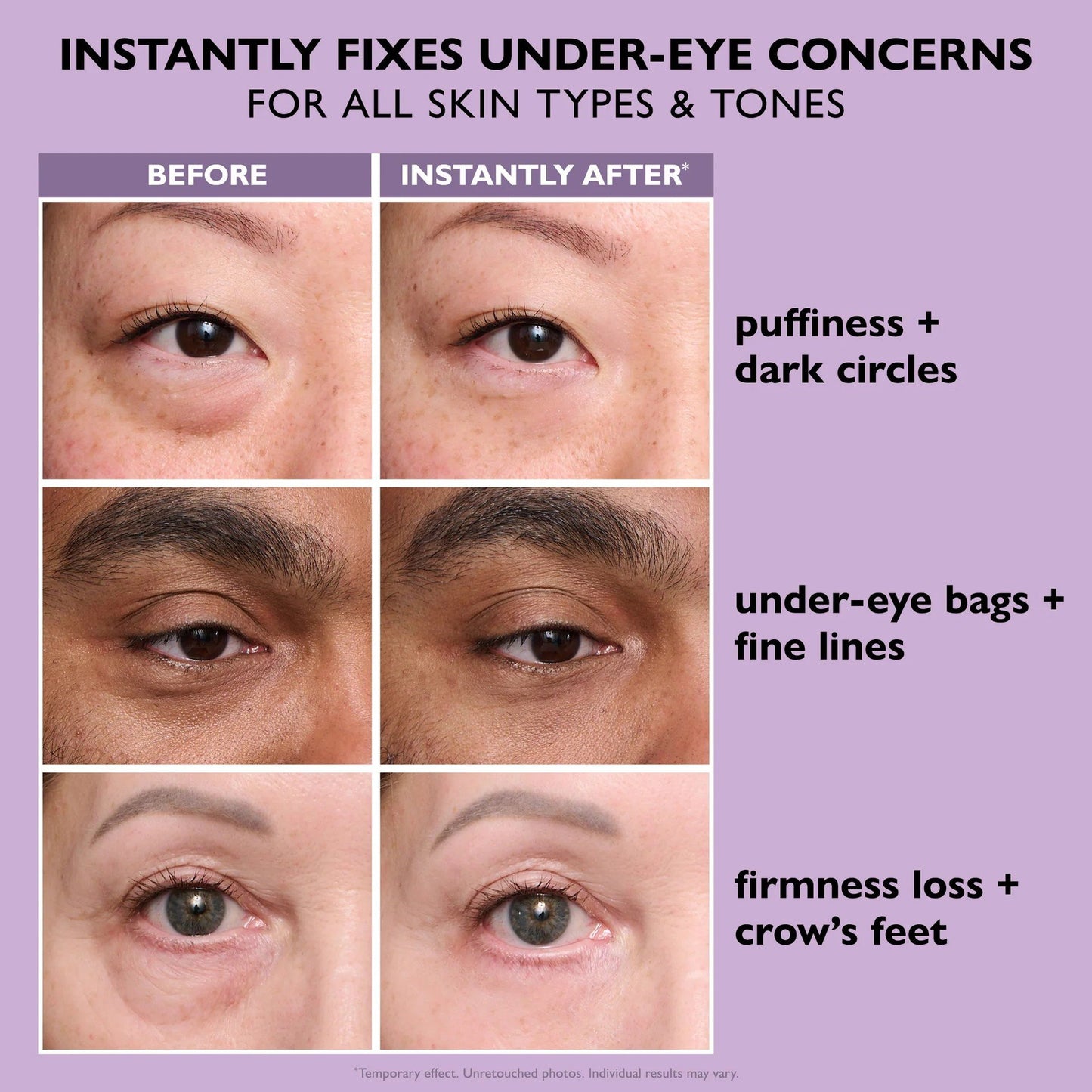 💥Sidste dag 49% rabat 🪄No-Filter Eye Tightener