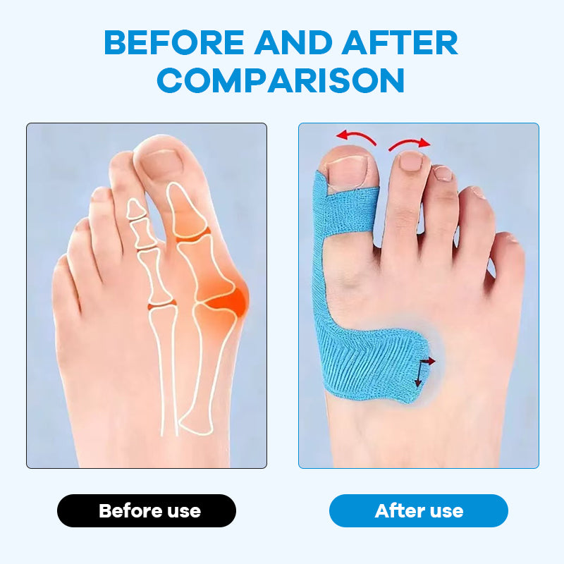 Forudskåret kinesiologitape til hallux valgus